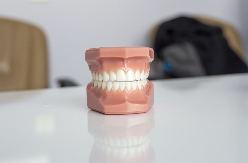 Eating Disorders, Dementia, and Bad Teeth